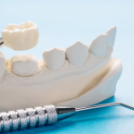 What is the process of getting a crown on a tooth implant?