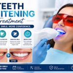 The Different Types Of Teeth Whitening Treatments
